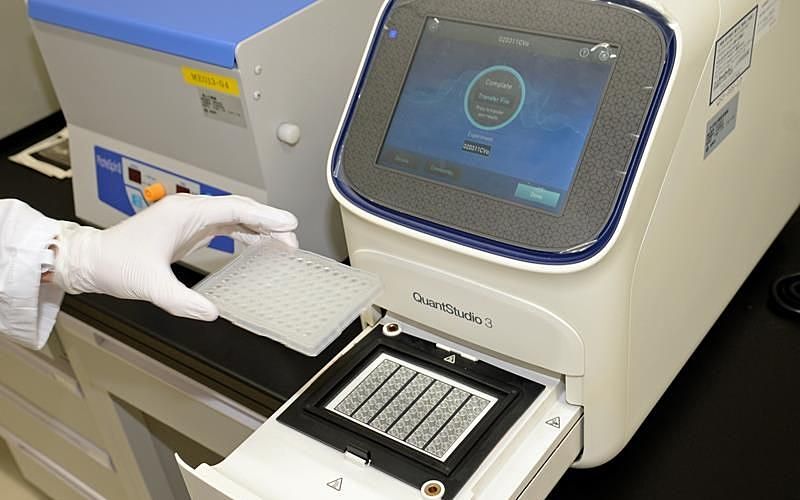 PCR検査について調べてみました！新型コロナウイルスで検査件数が増えなかった理由